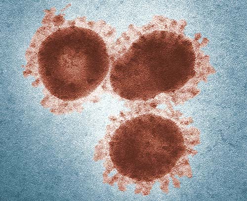 Infectious Disease
